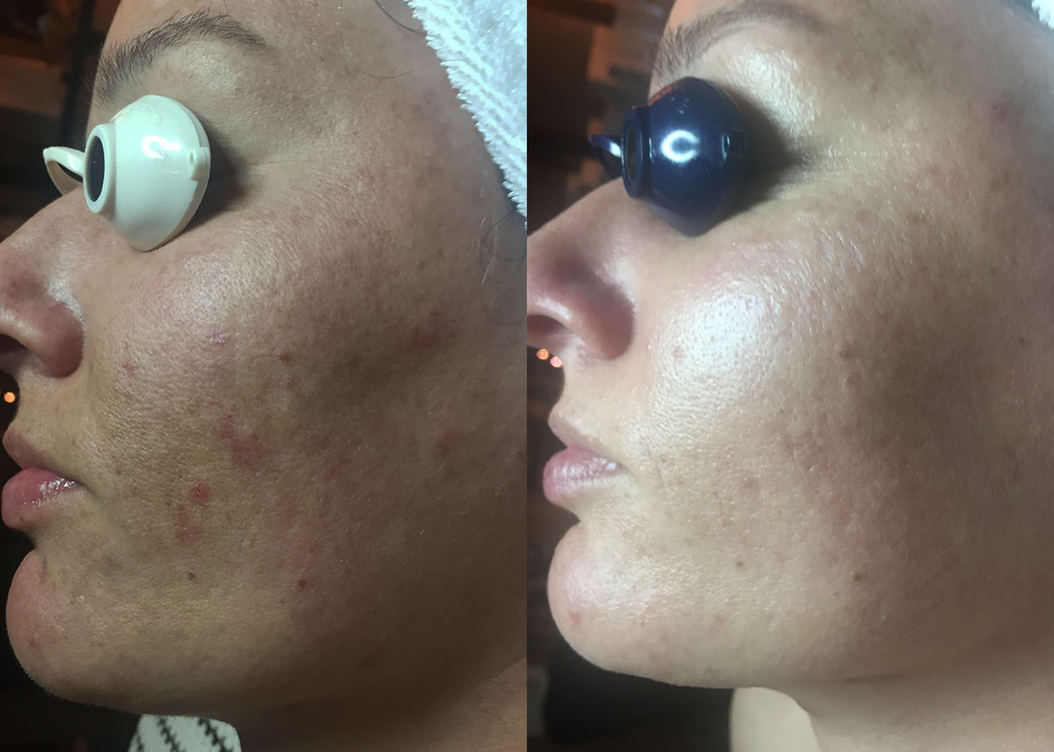 Age Repair: 4 Diamond Glow Facials