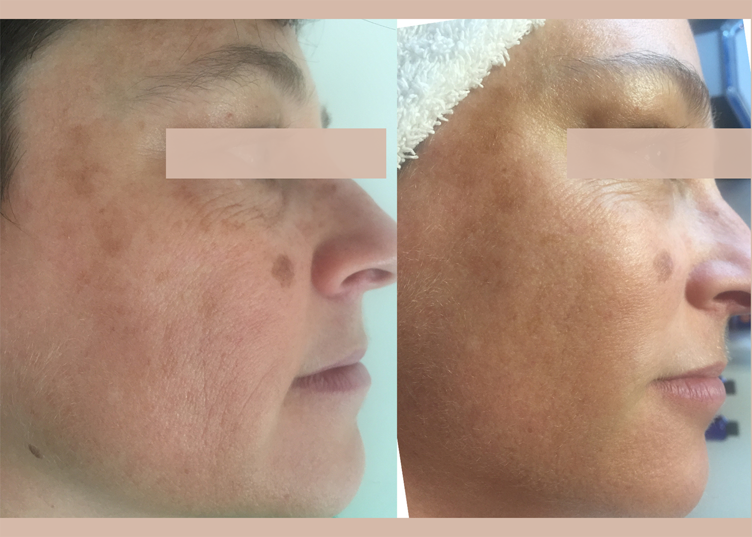 Age Repair: 2 Diamond Glow Facials