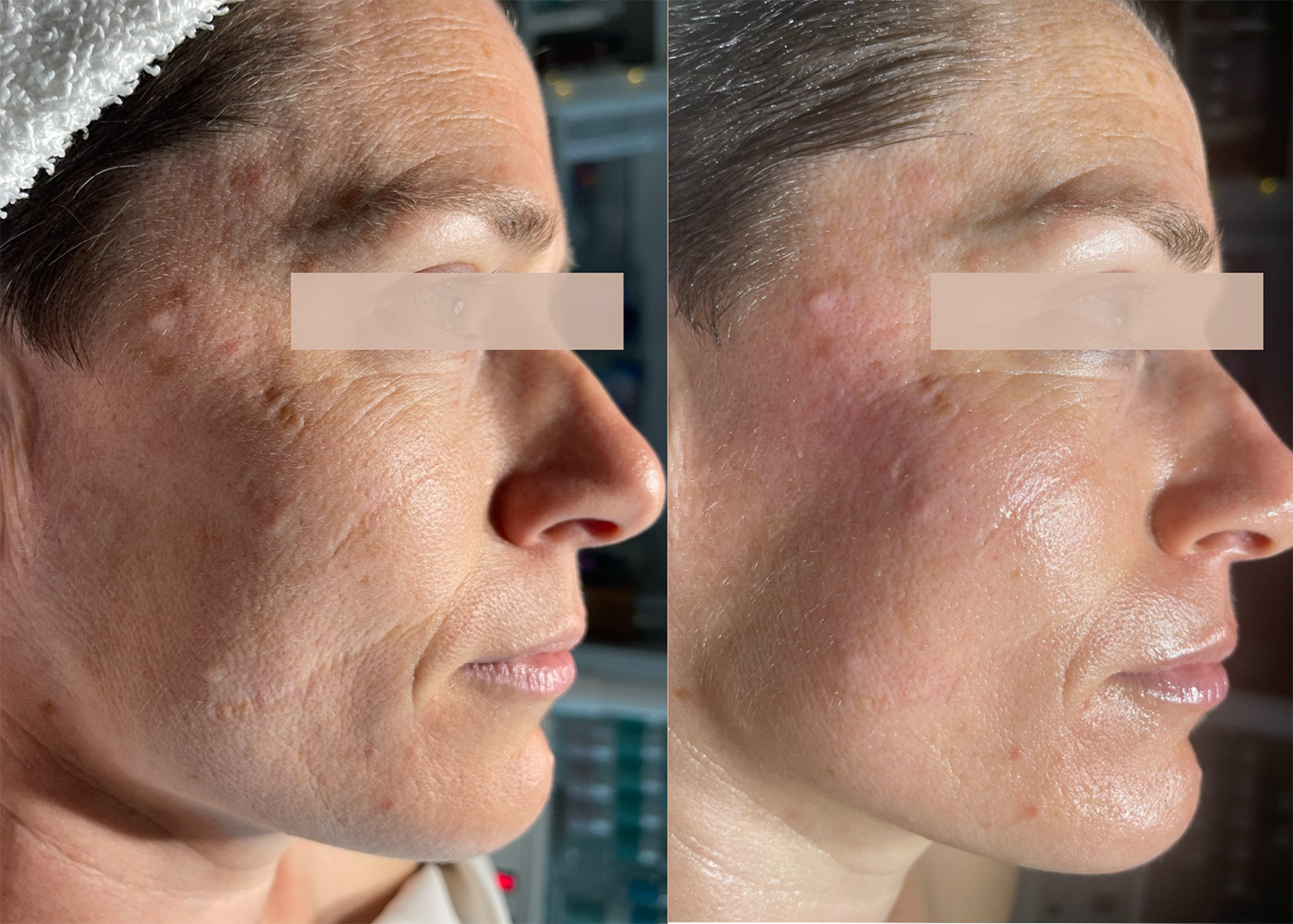 Age Repair: 2 Diamond Glow Sessions